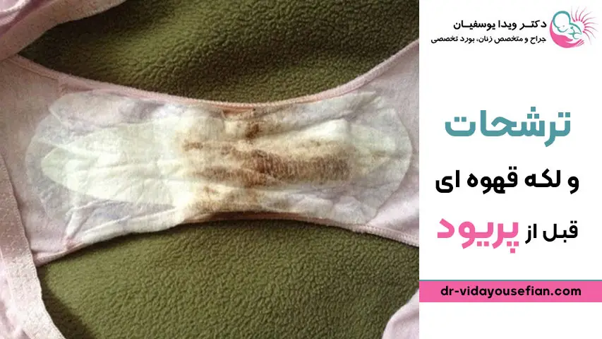 علت لکه بینی بعد از نزدیکی