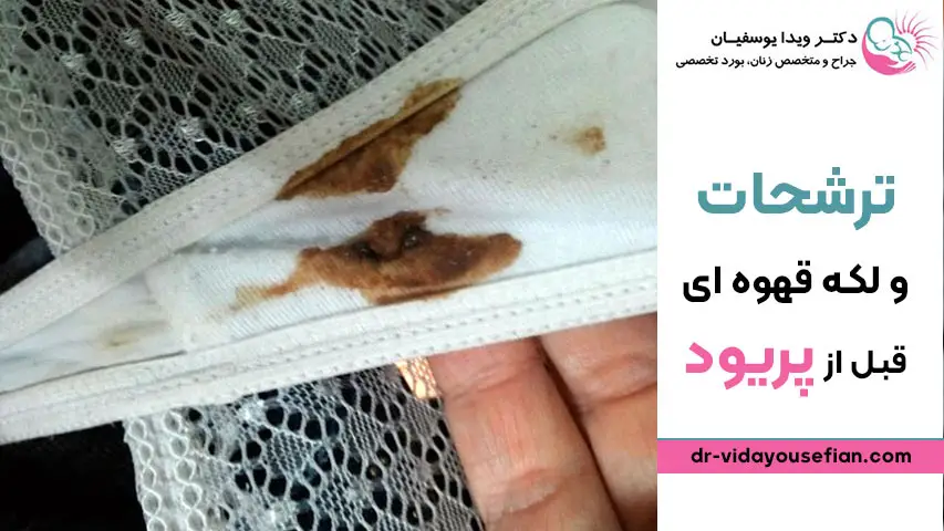 ترشحات و لکه قهوه ای قبل از پریود