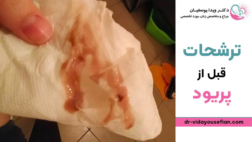 ترشح در بارداری