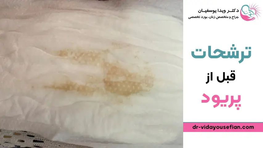 علت ترشح قهوه ای در بارداری