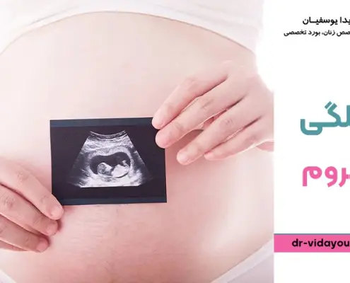 حاملگی با فیبروم ساب سروزال