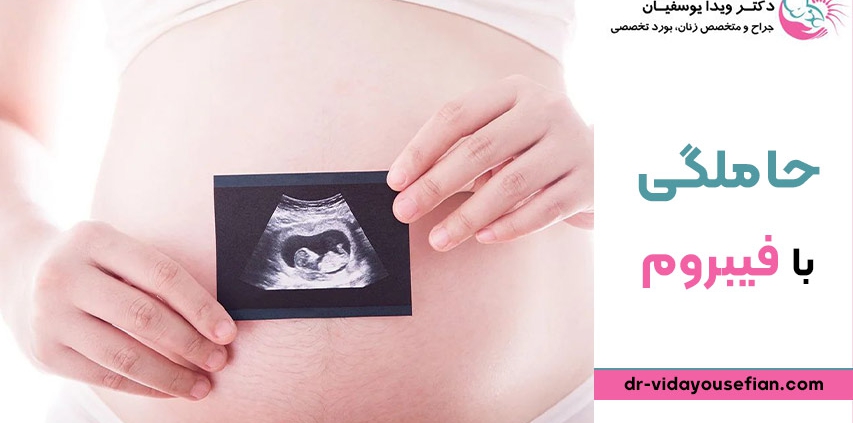 حاملگی با فیبروم ساب سروزال