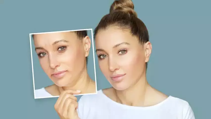 تزریق ژل برای زیبایی