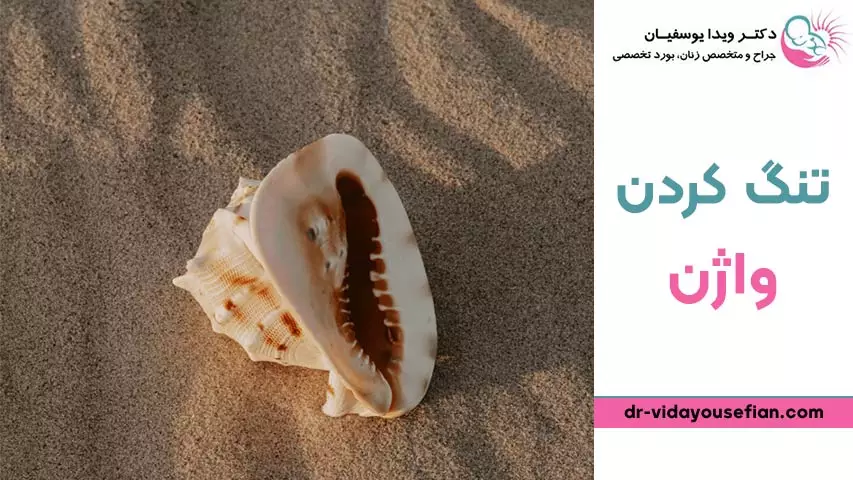 سؤالات متداول تنگ کردن واژن