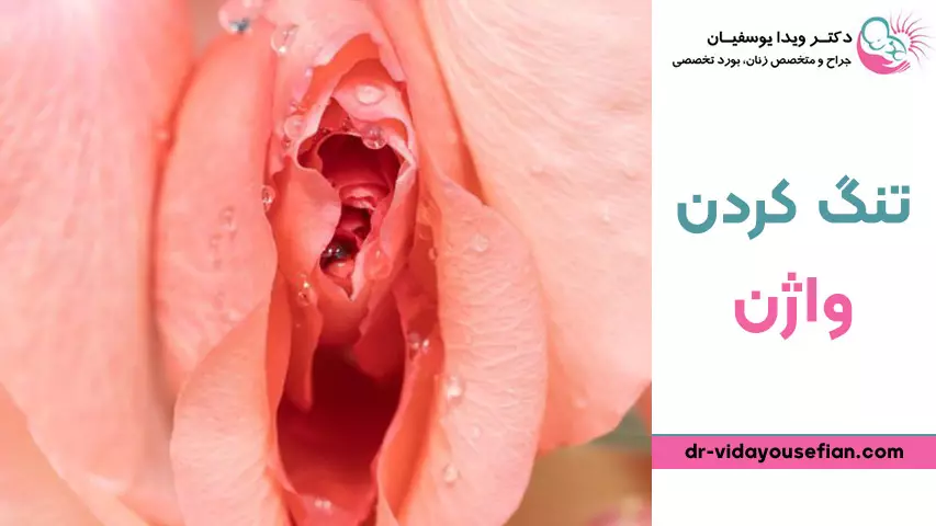 روش های تنگ کردن واژن