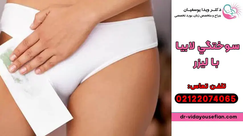 سوختگي لابيا با ليزر